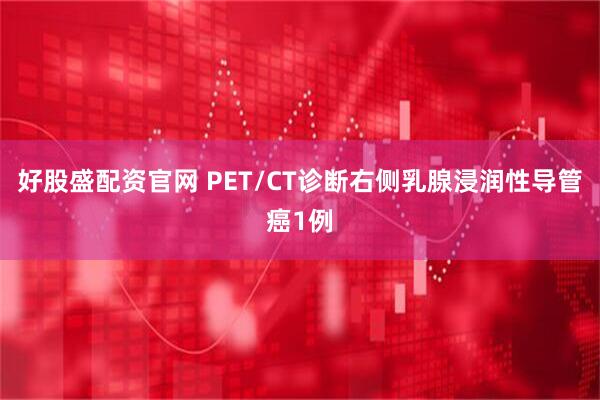 好股盛配资官网 PET/CT诊断右侧乳腺浸润性导管癌1例